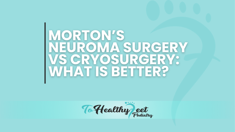 Morton’s Neuroma Surgery vs Cryosurgery: Which Option Is Right for You?